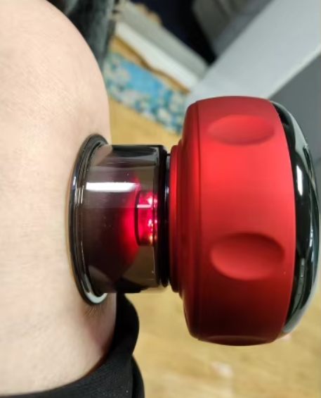 Smart Cupping Device in Use